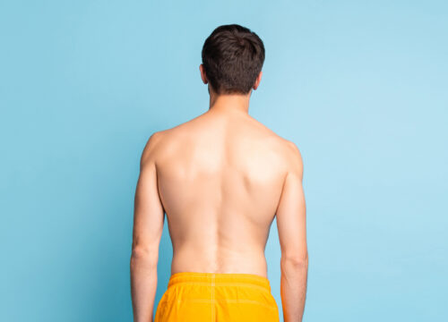 Man with no back hair standing in front of a blue background
