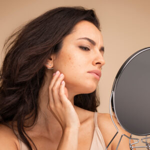 Is AviClear the Right Acne Treatment for Me? A Seattle Acne Expert’s Guide