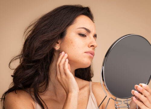 Woman looking into a mirror and examining acne on her face with a frustrated expression