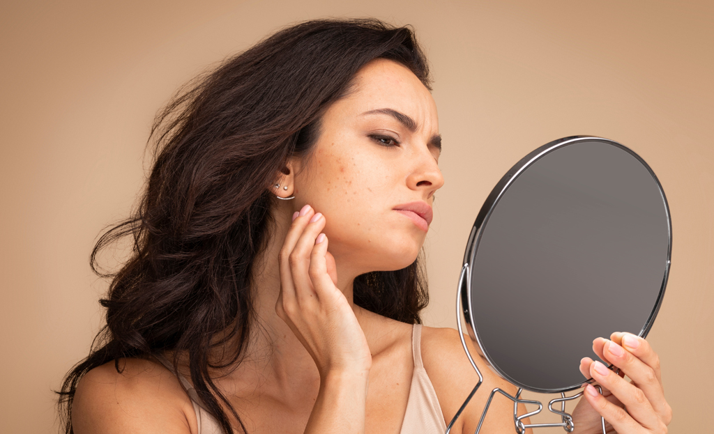 Is AviClear the Right Acne Treatment for Me? A Seattle Acne Expert’s Guide